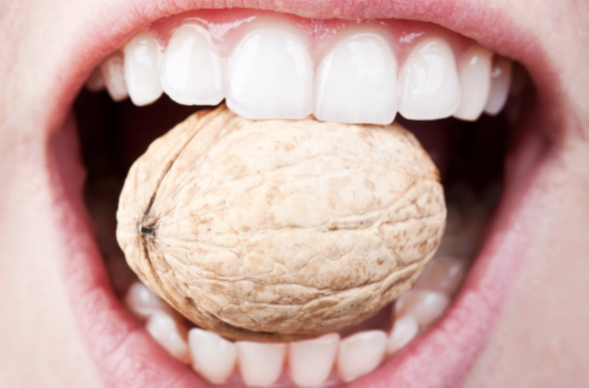 The enamel on the top surface on your tooth is the hardest part of your entire body. #ToothWisdom