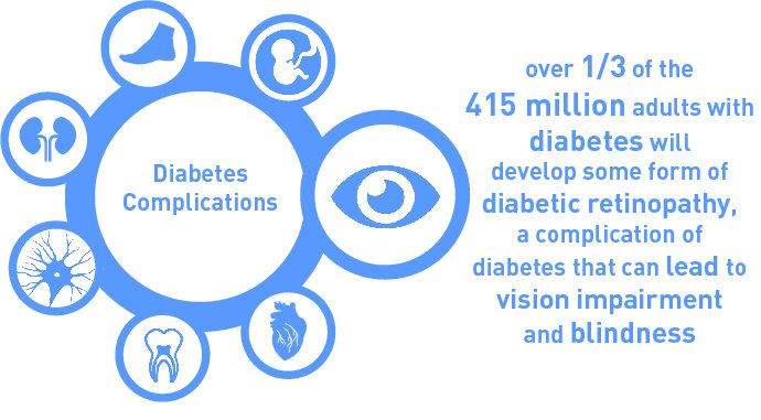 Over 1/3 of people w/ diabetes are affected by eye retinopathy leading to vision loss. Eyes on #diabetes this #WDD!