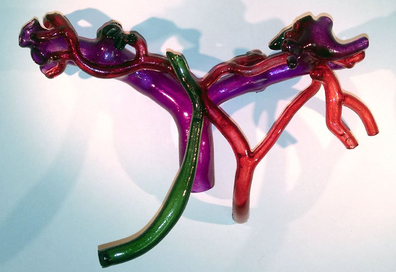 ClevelandClinic's tweet image. This 3D model replicates a patient’s bronchial tubes.