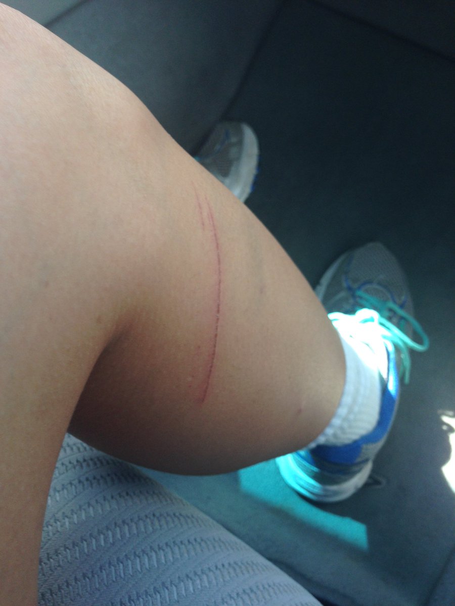issaybella's tweet photo. The first and probably not the only time I will fall off my bike. #triathlon https://t.co/QDmnopeMYY
