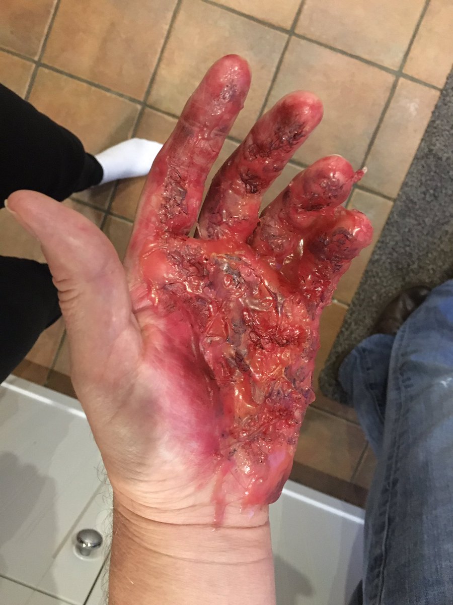 rubysfx's tweet photo. El Diablo inspired burn wound #SuicideSquad https://t.co/RfEG5TAsSF