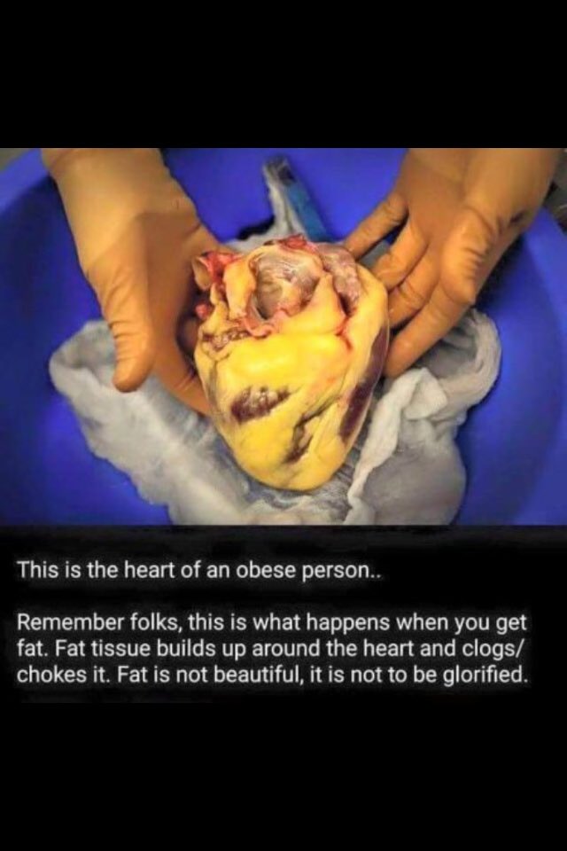 matty_bespoke's tweet image. @positivenjhx Lolz #FatShamingSavesLives
