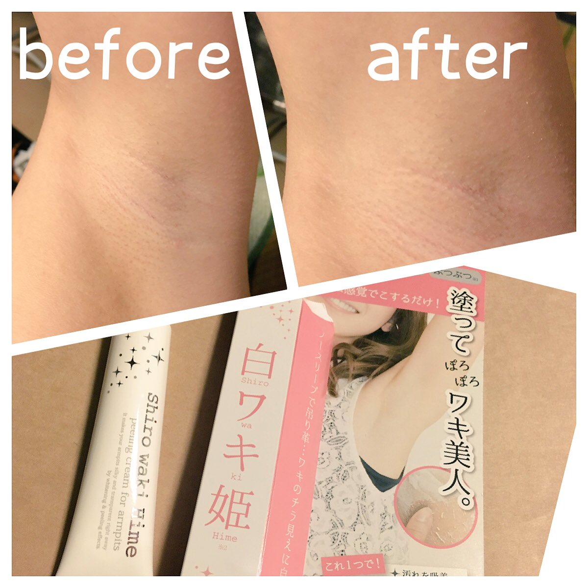 まあとん En Twitter ピーリングの脇バージョン 痛みはなし 1回では効果は分からないのでまだ続けてみます 白ワキ姫 モニター