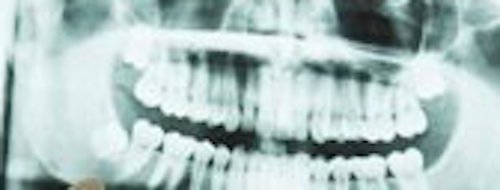 AyanaTechnicalS's tweet image. Top Tech #257 Fillings Heal Teeth, Artificial Pancreas, Ultrafast Photography

buff.ly/2ay46fH

#toptechblog