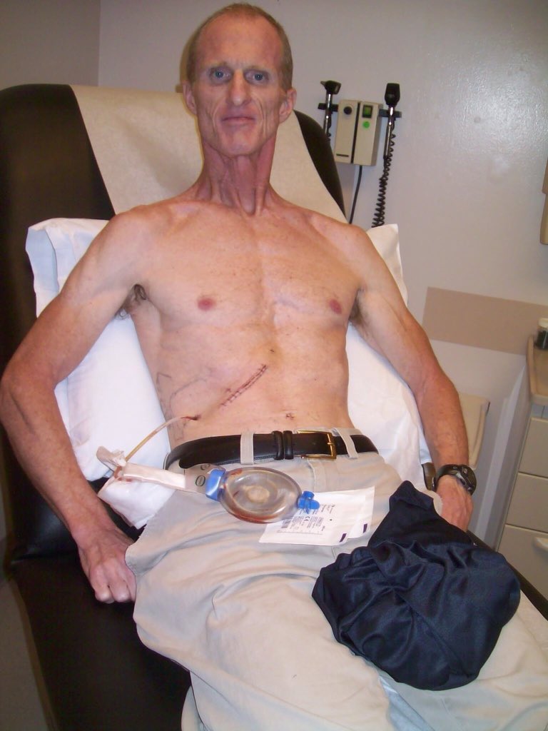 JamesHartline's tweet photo. I've battled AIDS, Cancer, 12 surgeries & 4 near-death episodes. Now, I'm #Running4God for 2017 Rock & Roll Marathon https://t.co/pufQVvusQ7