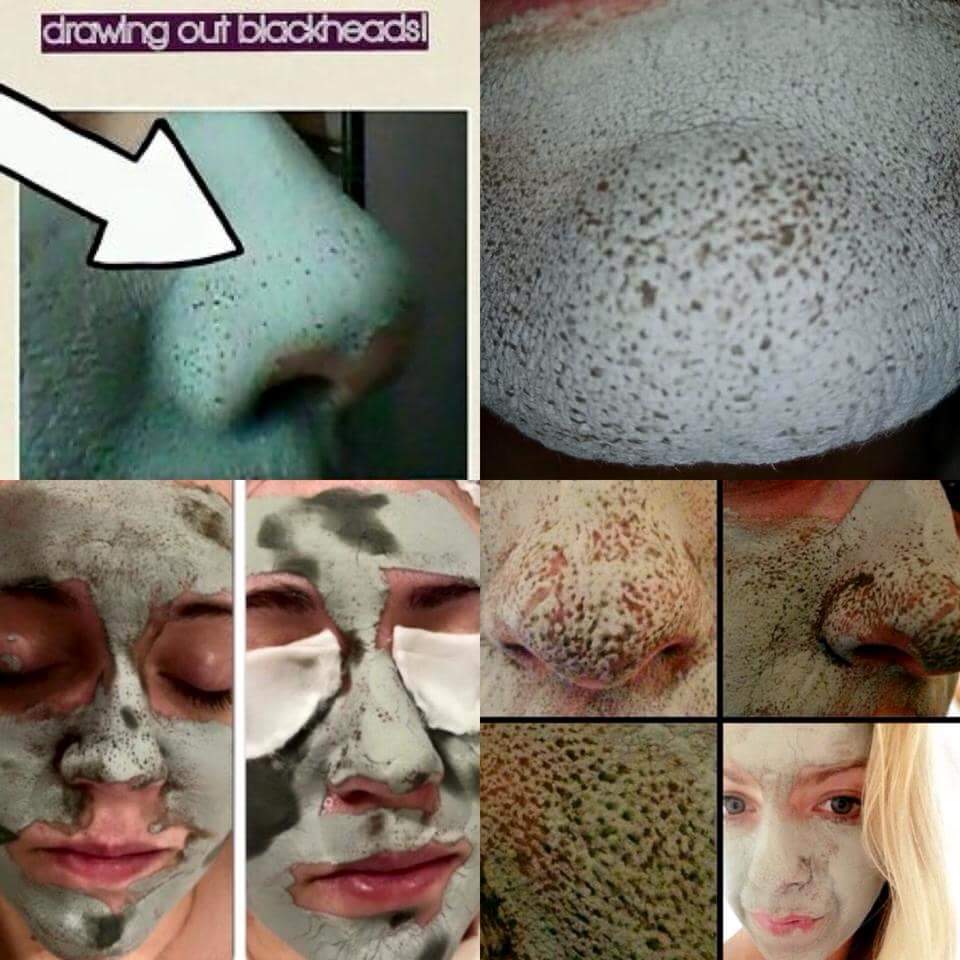 Our Mud Mask is a bestseller and you can see why!!! You can see the dirt and impurities being drawn out! DM to order
