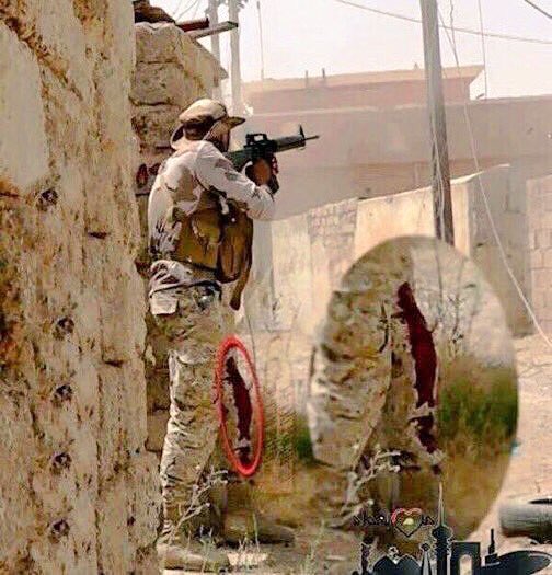 الصوره تقول :
أخاف أدنّق وأخذ بـ خاطر الجرح ، 
و يصيب ساق المملگهُ جرح ثاني ..