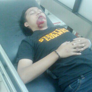 StreetLineCor's tweet image. Enggal damang priyan gope sing kuat,, semoga lekas sembuh supaya bisa kumpul lagi ceria tawa bareng"