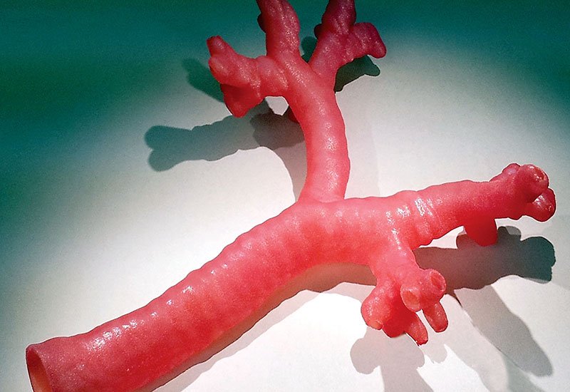MakerNest3D's tweet photo. Examples of how #3DPrinting is used for modeling and visualization of organs from body scans https://t.co/RCeDqlXHDc https://t.co/JfxVySF5Da