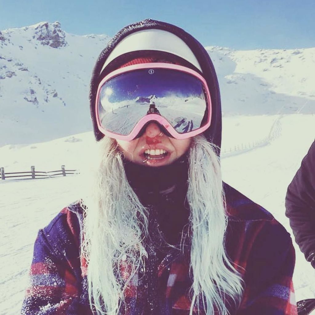 steezy_com's tweet image. @pixiesummer 0, park 1. #parkrat #girlswhoride #faceplant #slamsogood #slam #ouch #blood #… ift.tt/2bfu1Hd