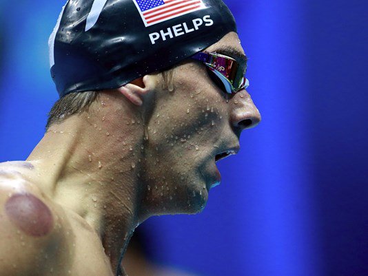 GratitudeDNA's tweet photo. @Attitudega ภาพจาก: BBC/financialexpress/huffpost/indianexpress

Michael Phelps ชอบcuppingมาก บอกไว้ได้ผลชะงัดนัก! https://t.co/nhi7RsdJX4