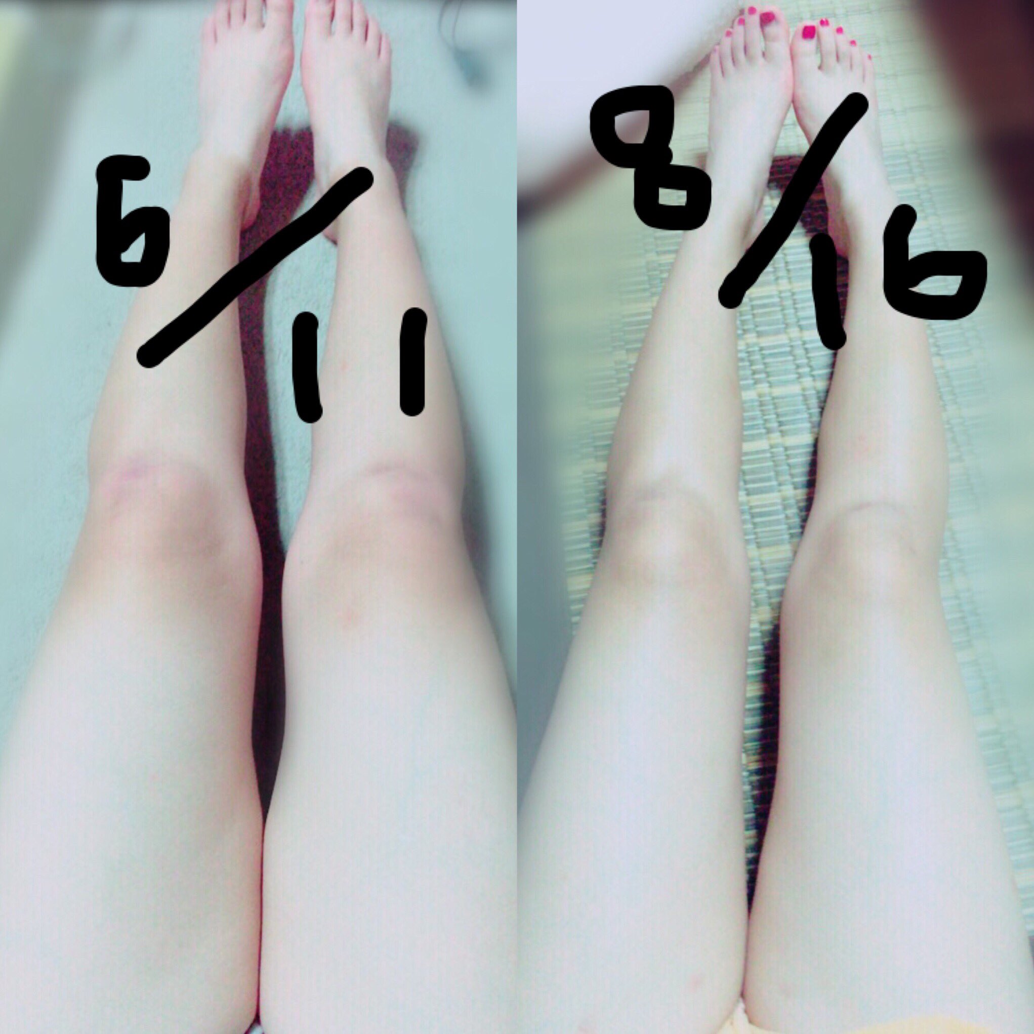 まき 足痩せしてるかな もっともっと痩せたい ダイエット垢 ダイエット仲間募集 ダイエット一緒に頑張ってくれる人rt 足痩せ 太もも痩せ 細くなりたい ダイエッターさんと繋がりたい まき 足痩せしてるかな もっともっと痩せたい ダイエット垢 ダイエット仲間募集 ダイエット一緒に頑張ってくれる人rt 足痩せ 太もも痩せ 細くなりたい ダイエッターさんと繋がりたい