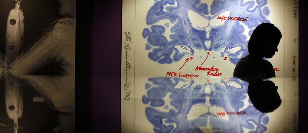 MiddInteractive's tweet photo. Interesting read on how being #bilignual rewires your brain https://t.co/KdqUbmCjEN https://t.co/mUY2iSZBuw