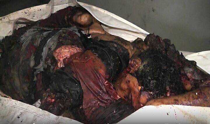m__almasmari's tweet photo. هذا الشخص لم يحرق في بورما وإنما بطائرة العدوان السعودي عندما ضربت مصنع للبطاطس في العاصمة صنعاء وذهب ضحيته العشرات https://t.co/c2Udb9YeXi