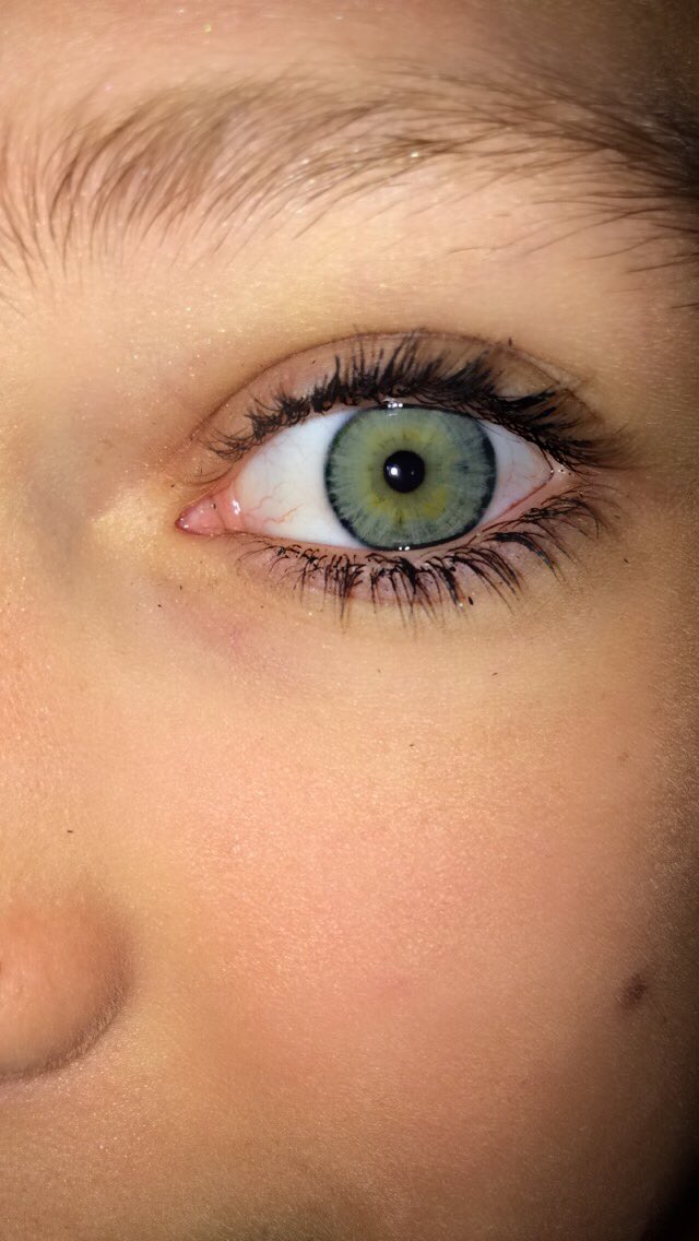 gilinskyscub's tweet image. #swimforsight @jackgilinsky @JackJ