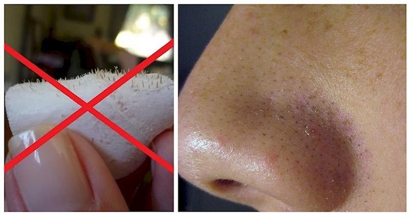 RT HeaIthDaily: The Easiest Trick To Remove Blackhead And Get A Glowing Face Is HERE
… x.com/FemaIefit/stat…)