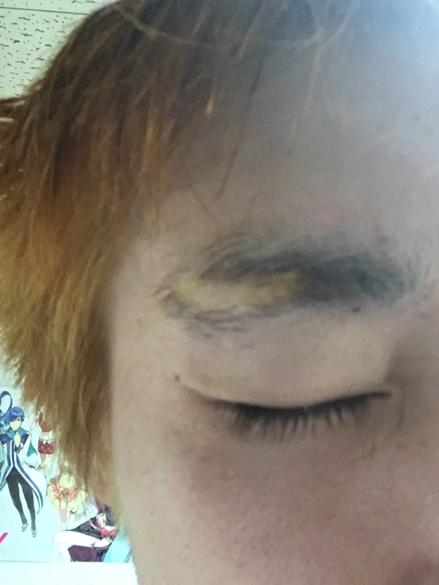 やべ やべえ Pa Twitter 悲報 やべ氏 ブリーチをかけるも色むらが激しく それどころか眉毛に変にブリーチがついたことによる眉毛消失バグ発生