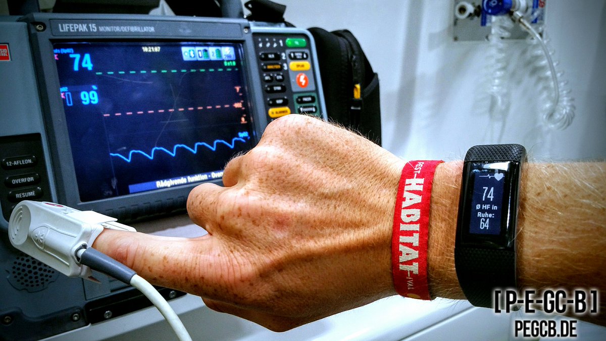 pegcb_de's tweet photo. Now I don't need a defibrillator more...
#Garmin #VivoSmartHR+ #Fitness #HeartFrequency #BeatYesterday
@GarminDACH https://t.co/QTHvMTD1UJ