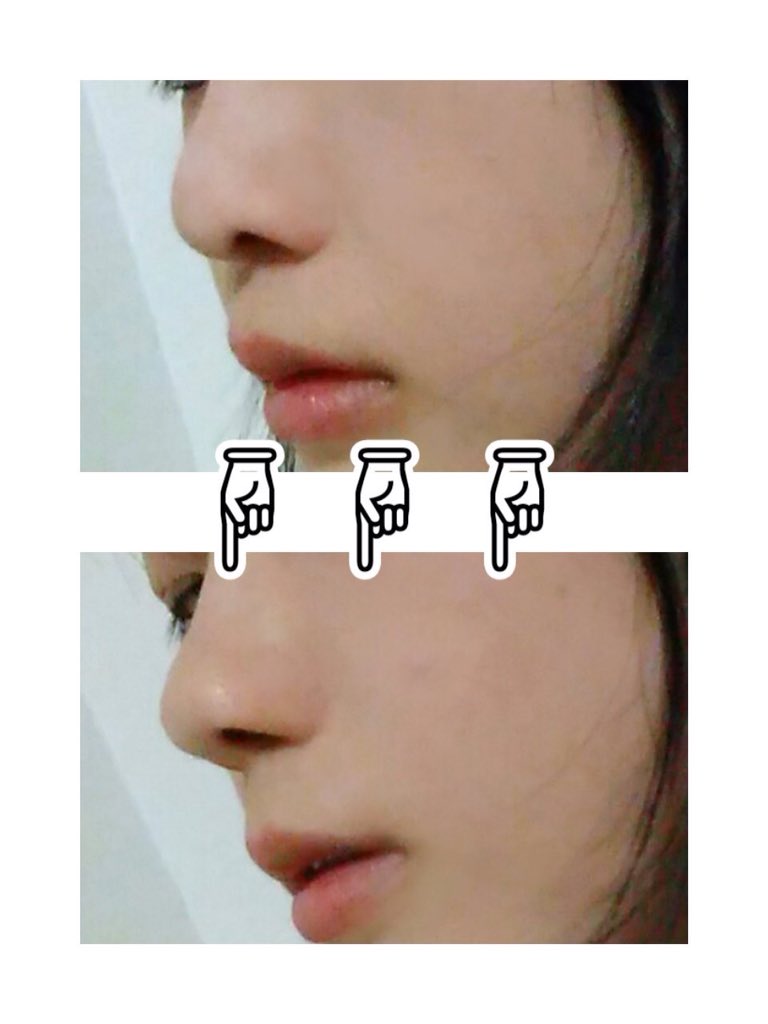 春宮 美琴 手作り鼻プチ作ってみた ビューラーの替えゴムを2 8cm位に切る 爪ヤスリでやする ピンセットで上弦の向きで入れる これだけ 滅多なことではズレない 鼻かんでも 薬局で 75で買えた レイヤーのオススメ商品プレゼン大会 春宮 美琴 手作り鼻プチ作ってみた ビューラーの替えゴムを2 8cm位に切る 爪ヤスリでやする ピンセットで上弦の向きで入れる これだけ 滅多なことではズレない 鼻かんでも 薬局で 75で買えた レイヤーのオススメ商品プレゼン大会