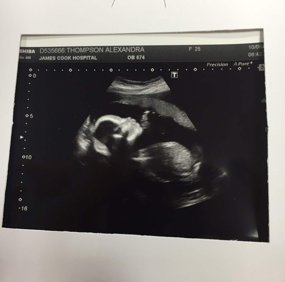 callumcuthbert's tweet photo. Baby Cuthbert coming soon 2016.   😍👶🏻🍼 https://t.co/qoQihmBz5Z