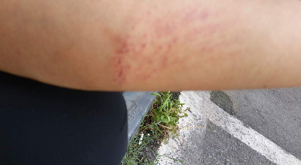 오늘은 운이 좋았습니다 담벼락에 실외기가 설치되어 있다보니 안전장비도 무용지물
잘떨어져서 살았습니다

#samsung