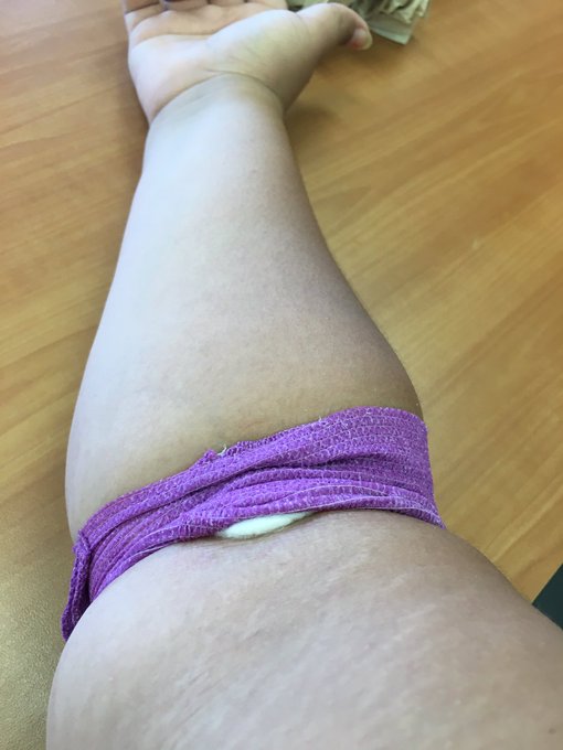 All tested! But they didn't give me the cute bandaid from @TalentTesting https://t.co/WZV8dd69qM<a href="/tag/feet"class="tags"><span>#feet</span></a><a href="/tag/bbw"class="tags"><span>#bbw</span></a><a href="/tag/clips4sale"class="tags"><span>#clips4sale</span></a>