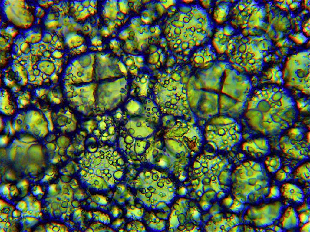Our Rye #Sourdough starter magnified 400x by Dave Beecher
Many thanks to <a href="/oliver_moore/">Oliver Moore</a>
#Realbread #RealbreadIreland