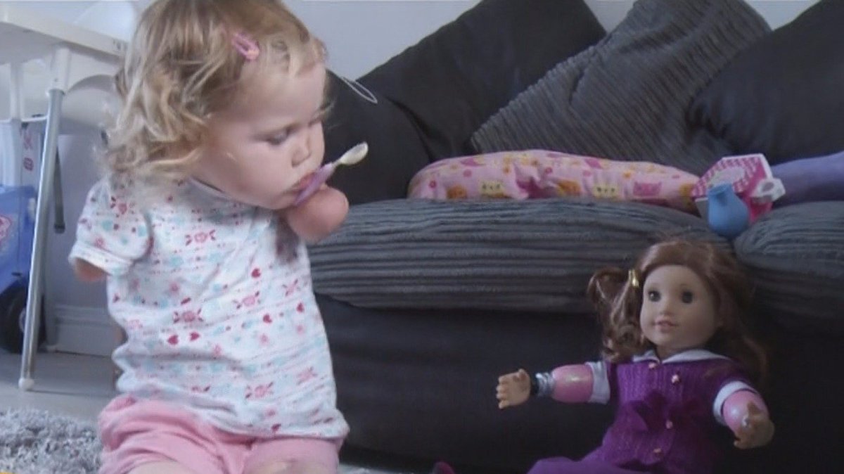 Watch: Toddler who lost her limbs to meningitis overjoyed with lookalike doll itv.com/news/2016-08-1…