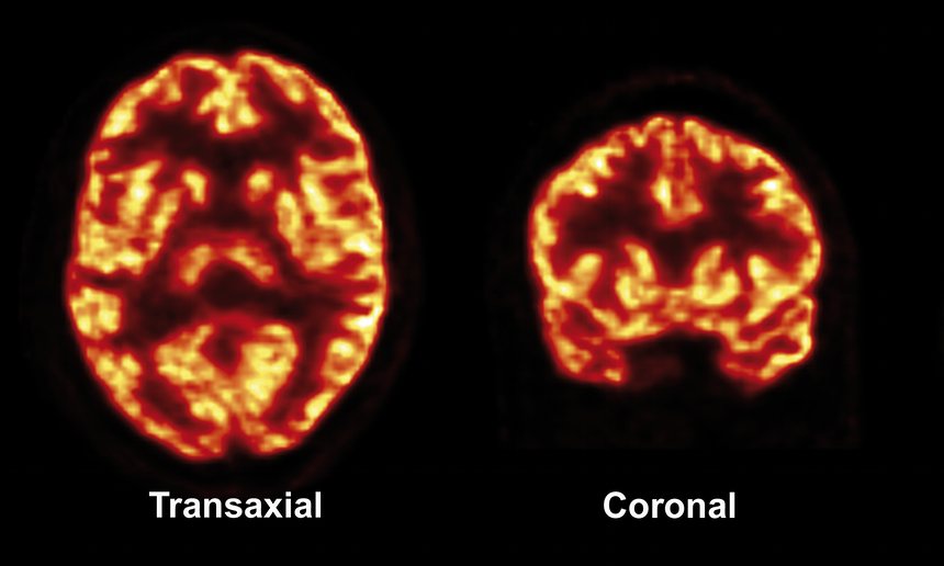 Neurophilosophy Blog tweet media