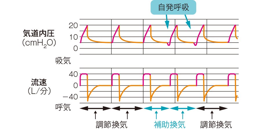 ☆人工呼吸器の「モード」ってなに？ 「患者の自発呼吸の有無