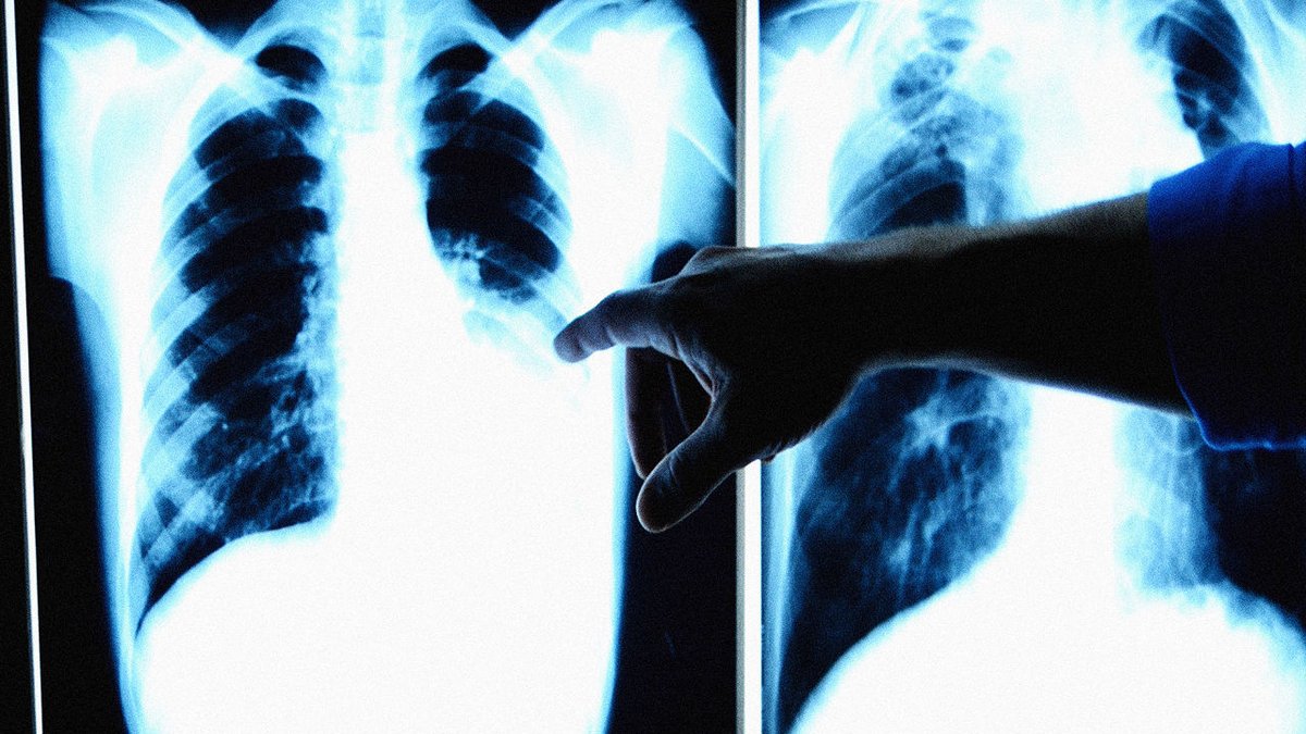 CDW_Healthcare's tweet image. Why are medical records such a hot commodity for hackers and thieves? via @FastCompany ht.ly/XsWh3032prC