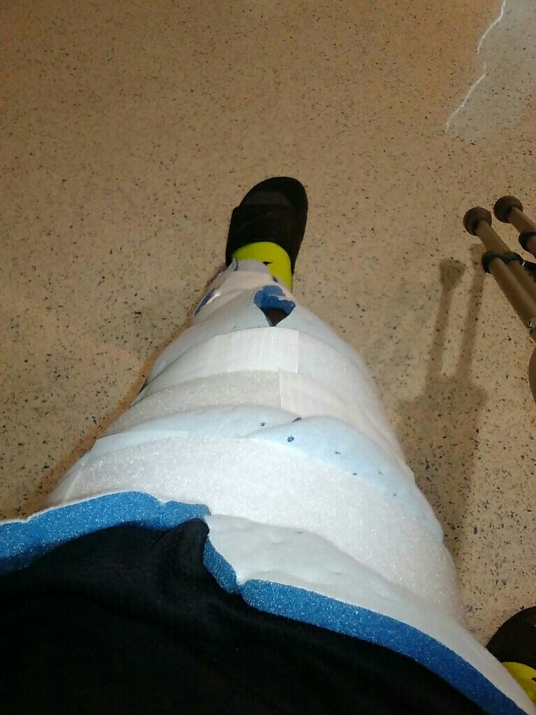 99star__'s tweet photo. Minor setback ๐ท๐ฏ
#foramajorcomeback https://t.co/09ogSbQGsc