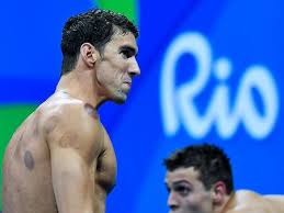vattman_11_11's tweet photo. y si el nos esta pidiendo ayuda por sus marcas en la piel? yo opino que #SavePhelps https://t.co/IVCs1V2sTm
