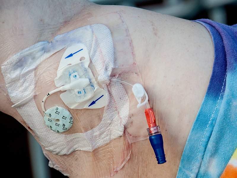 MedscapeSurgery's tweet image. Can RNs remove #PICCs? wb.md/2aNUyjp