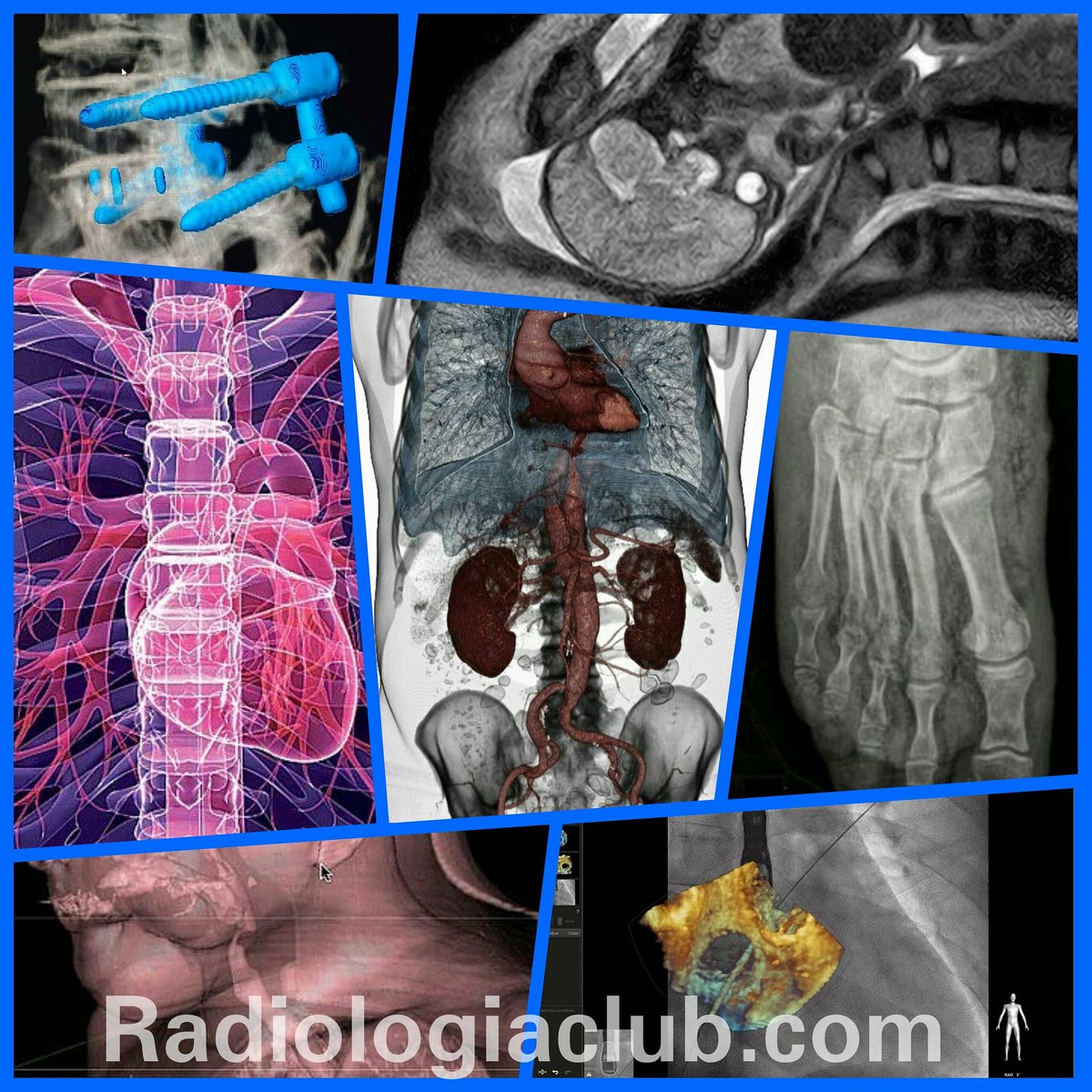 MiguelDlaCamara's tweet photo. #Radiologia Imagen multimodal y postproceso no se hacían hace 15 años.
#Innovación #TechRad
https://t.co/3V9Yfq0T6h https://t.co/yRBNm0VEo4