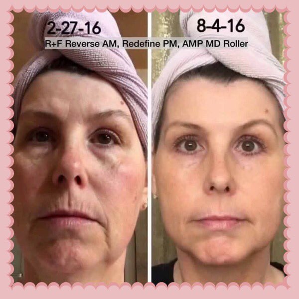 sara_m_conger's tweet image. 😳Wow!😳 
Eva has taken 🗓YEARS🗓 off her appearance! 
#amazingchanges #reverse #redefine #ampmdroller 
#rodanandfields