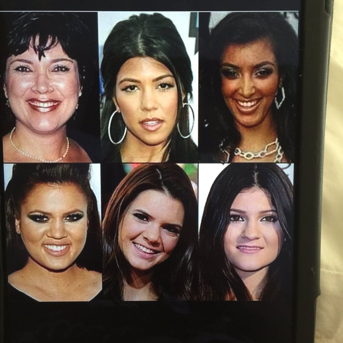 Who does Kim Kardashian look like before surgery.... ? 