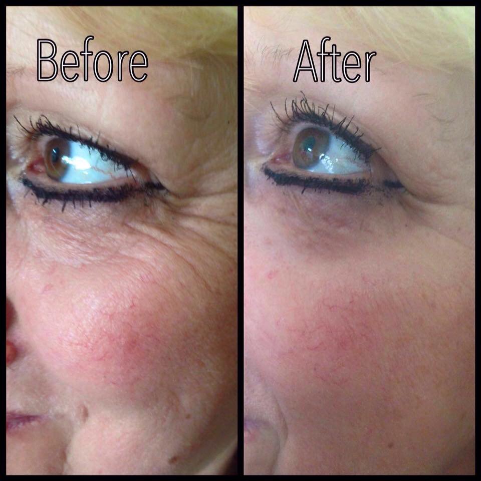 JouveAntiAging's tweet photo. The results speak for themselves. #Jouvé. All natural. All you. #jouveantiaging https://t.co/5HJ8UkIFSy