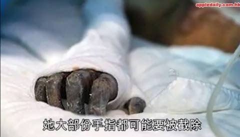 Re File リファイル Twitter પર 中国 23歳女性教師が13歳少年に火を付けられ全身大火傷を負う T Co Zcwcxcldkc