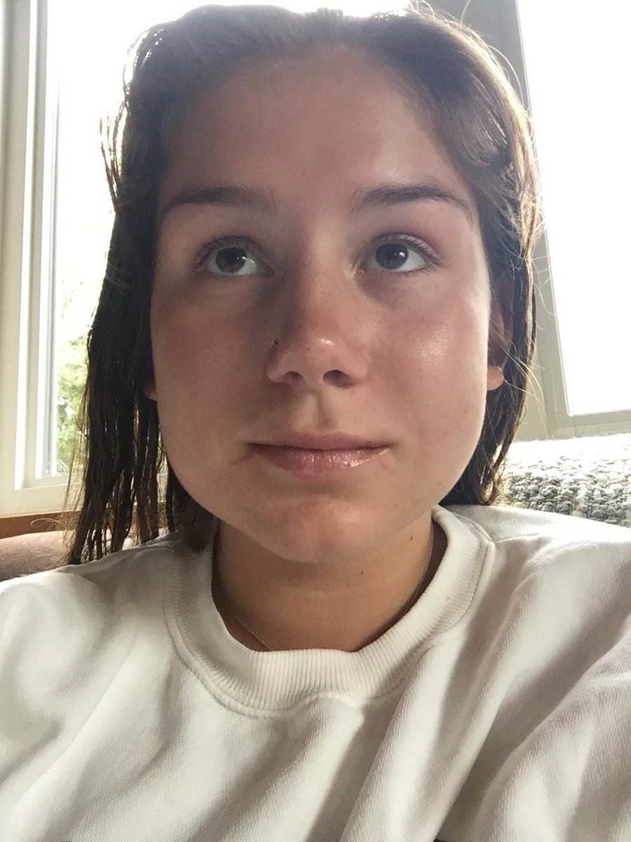 steelelancon's tweet image. Carl wheezer or Steele? #wisdomteethprobs