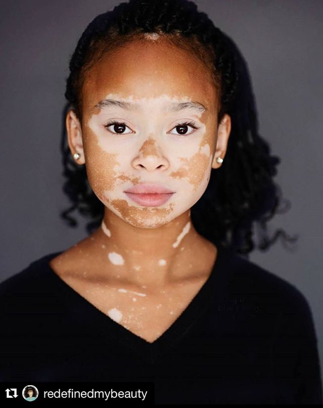 DiversityColFAM's tweet image. &quot;Being called weird is like being called limited edition, meaning you’re something people don’t see that often...&quot;