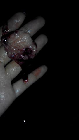 kosmetik97's tweet photo. Jual obat aborsi asli cytotec penggugur kandungan .Call: 087733933711 / pin: D16B70DE. https://t.co/4hjTukGcjT https://t.co/oqucW4OZ8N