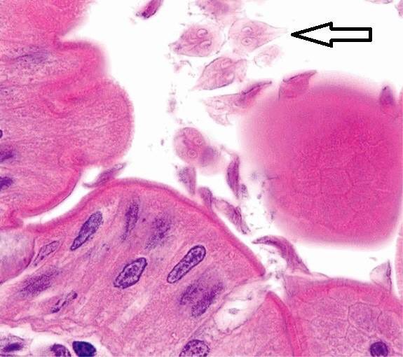 giardia pathology outlines)