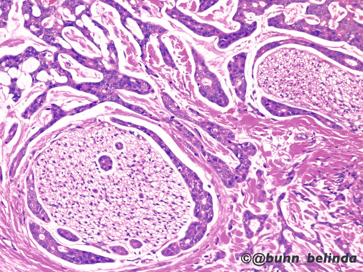 Belinda Bunn tweet media