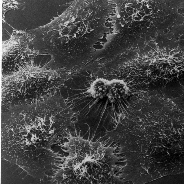 TheScientistLLC's tweet photo. Mutations in Stem Cells Drive Cancer Risk in Mice https://t.co/XzqToGjdwK https://t.co/FyZUkAlkYW