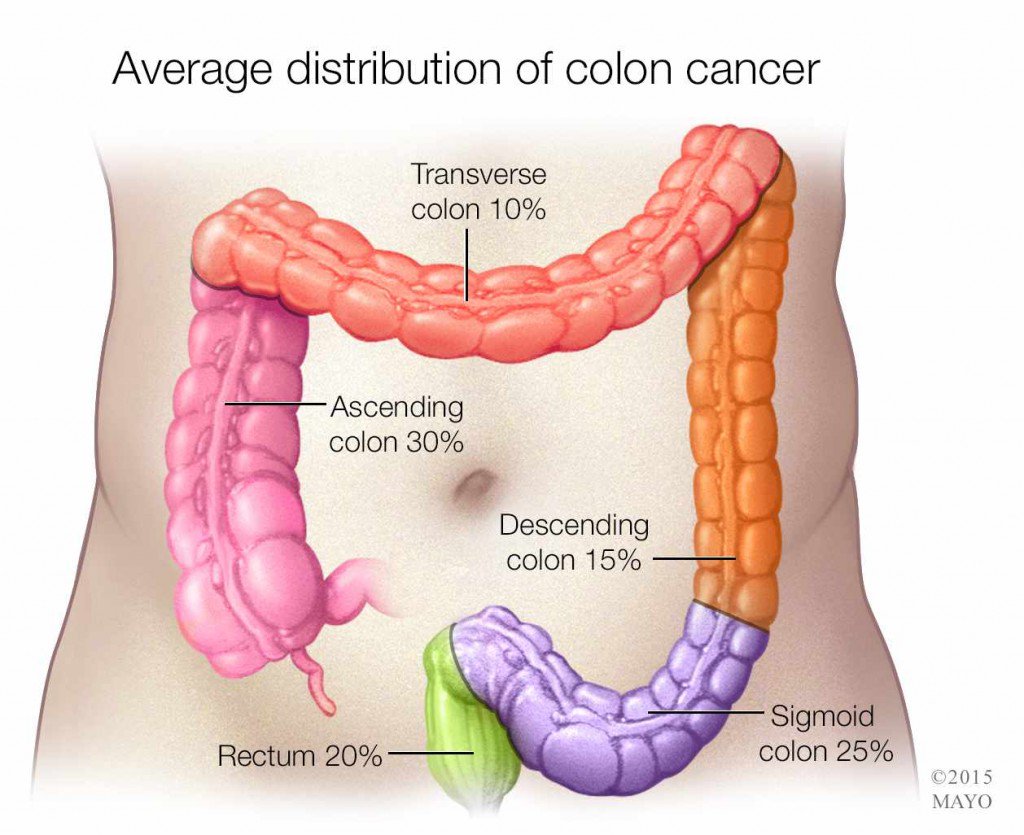 Next on MayoClinicRadio, Dr. Conor Loftus on coloncancer screening. New