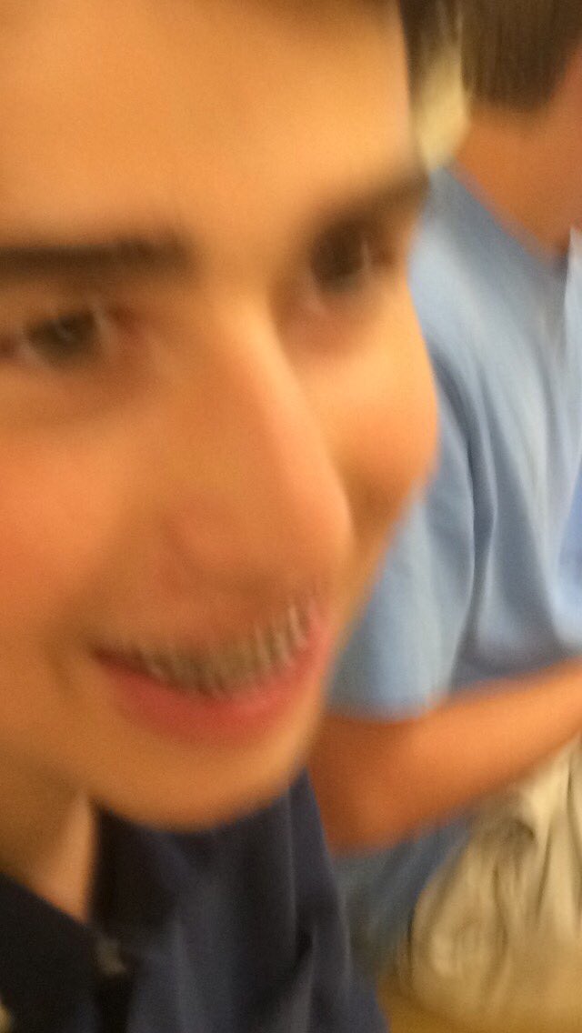 NatalieTipsword's tweet photo. When you just recovered from breaking your jaw and you get appendicitis
#OnlyJames https://t.co/Ek1MUFJpkn