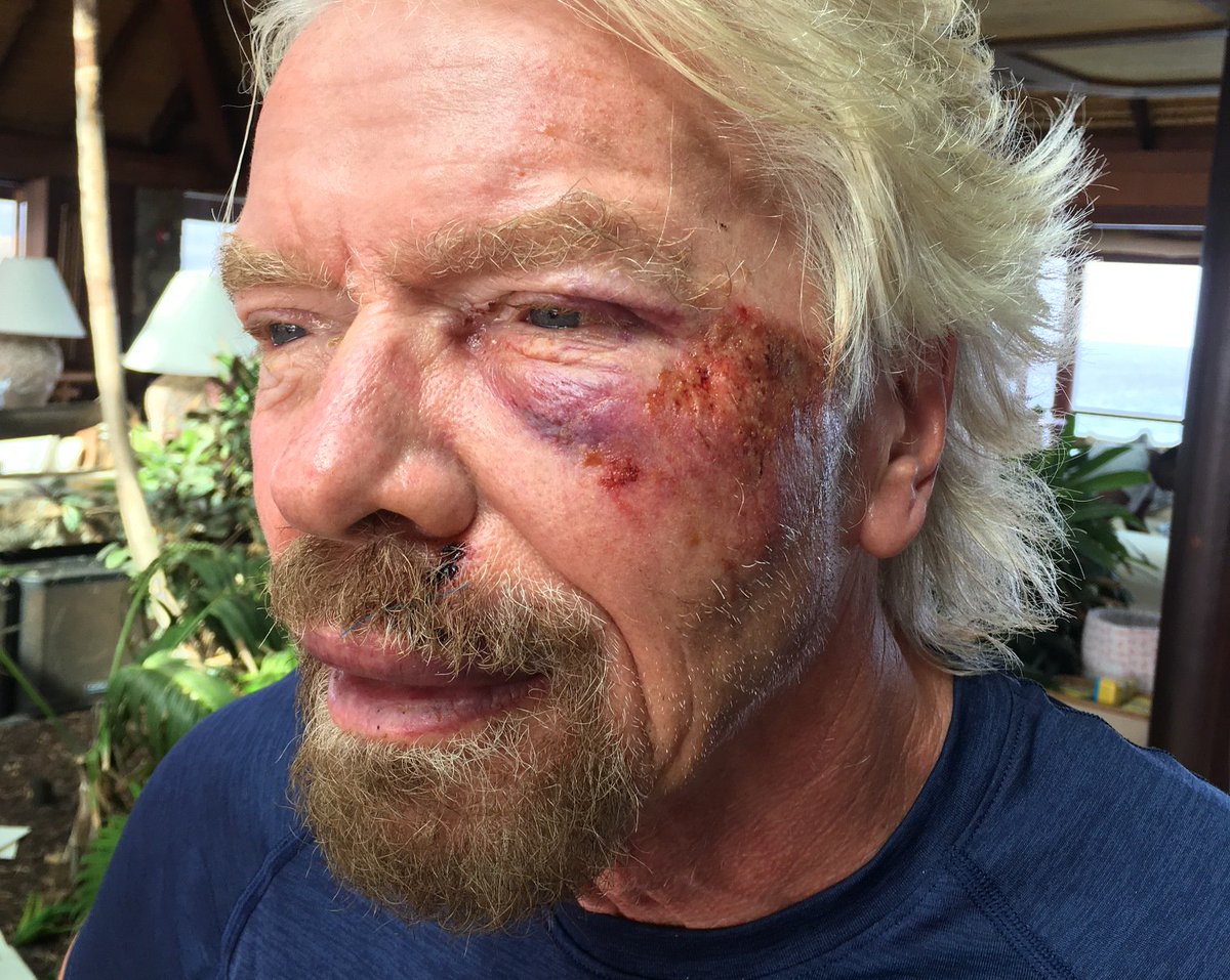 If you fall flat on your face, at least you’re moving forward. Took my advice literally! virg.in/JPxtm
