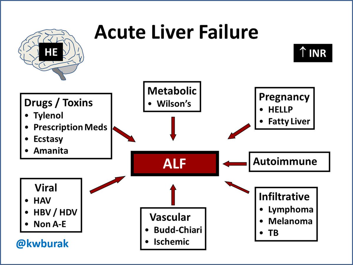 Kelly Warren Burak on Twitter: "Acute liver failure is the most ...