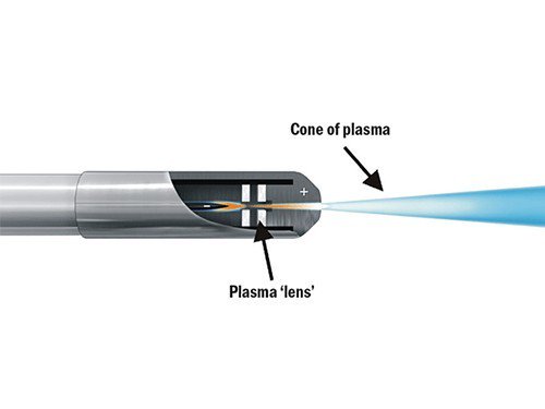 Interesting_Bio's tweet image. Первая в России кардиооперация с использованием плазменного скальпеля. medportal.ru/mednovosti/new…